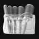 Kit 5 Brosses SPEED XL Thermal Brush - Ceramic + Ion